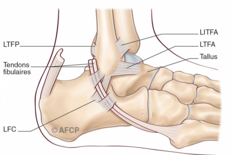 Instabilité de cheville